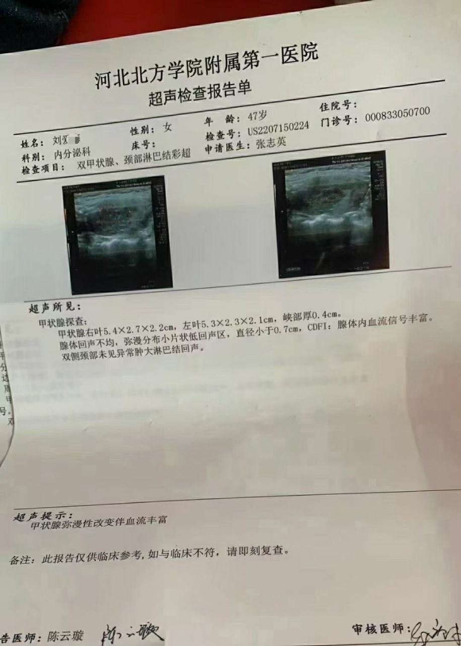 结节治愈案例分享 67刘女士,甲状腺结节囊实性3类,治疗时间两个半月