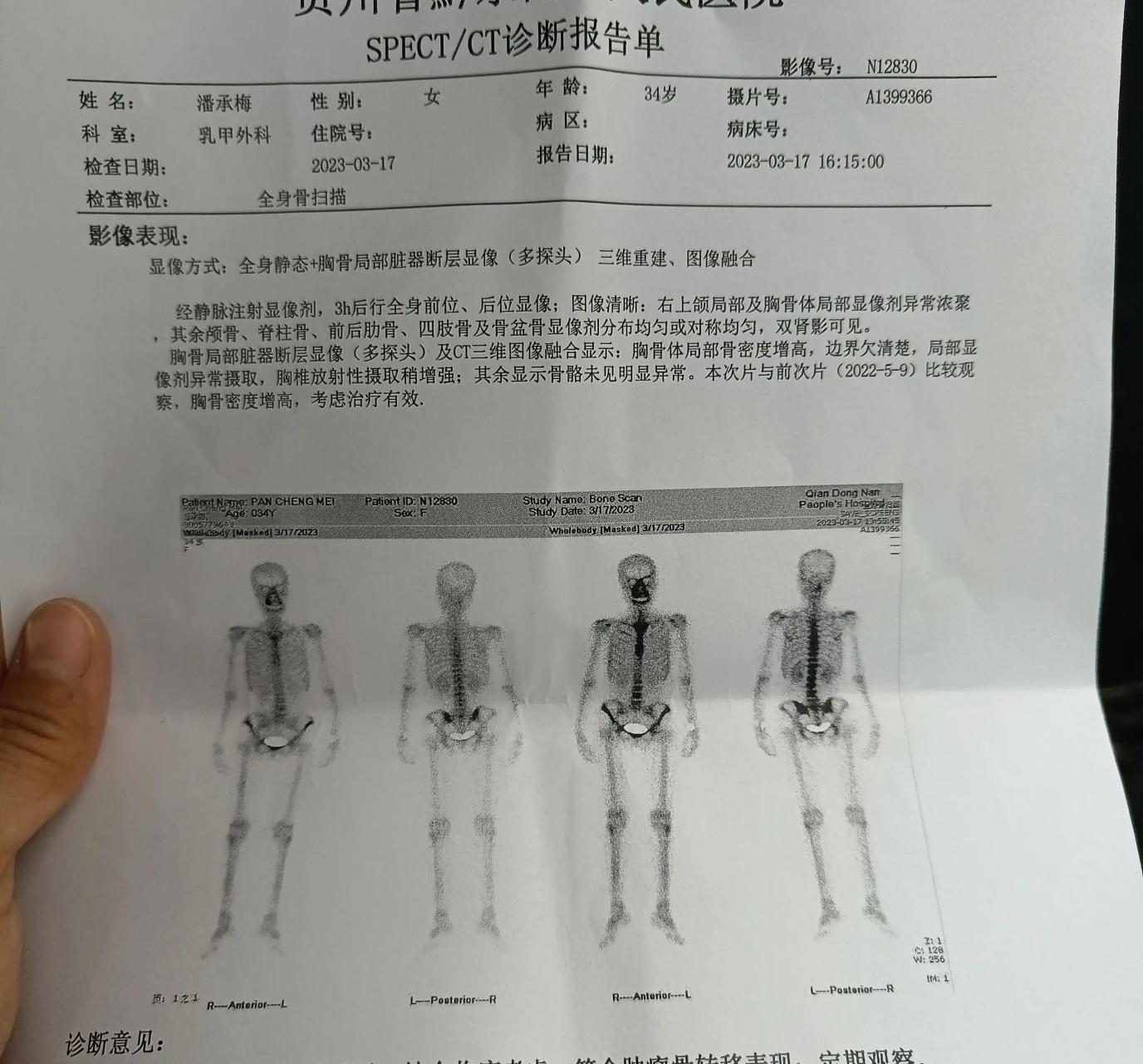 这两天情绪处于一个低落状态,从骨扫描的报告出来,说我胸骨体局部代谢