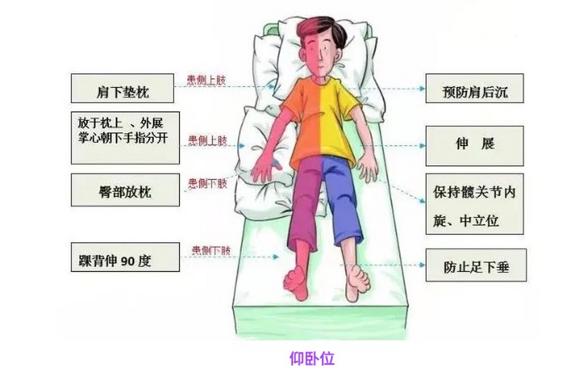 脑梗偏瘫后,良肢位摆放究竟怎么做才正确呢?