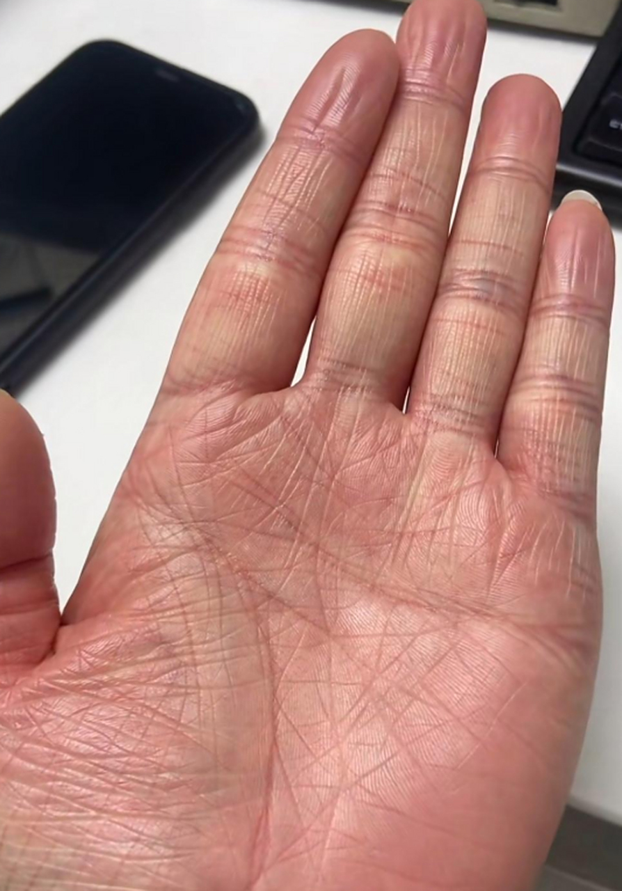 据说乱手纹是想心事太多了,这这样吗?