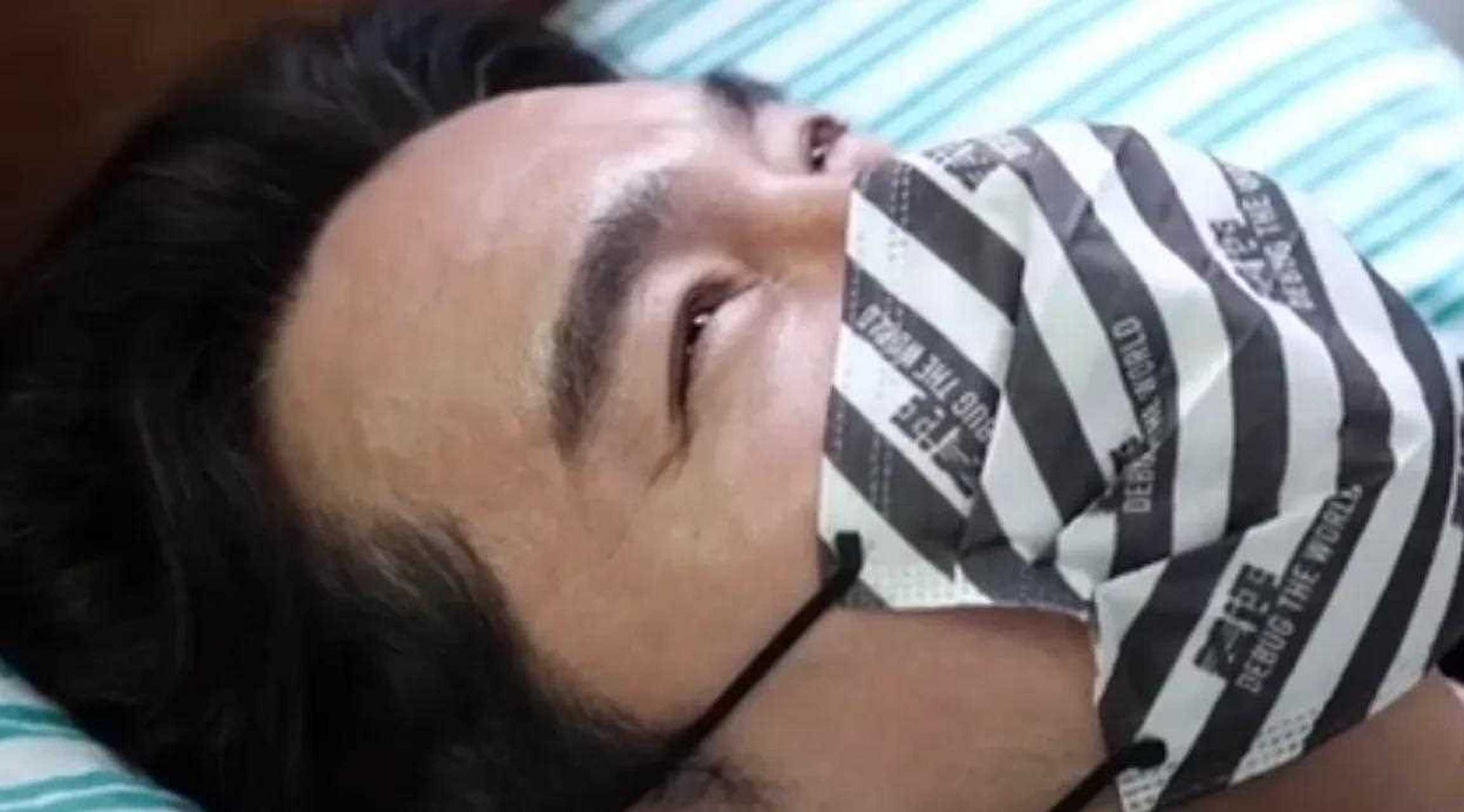 胡兵在社交平台上发布自己眼部手术全纪录的过程,原来,胡兵做完郎射