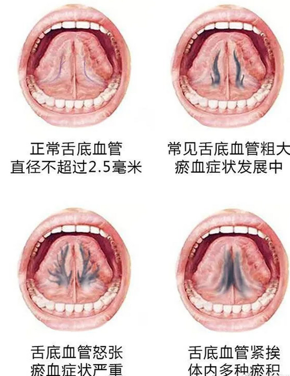 舌头构造真实示意图图片