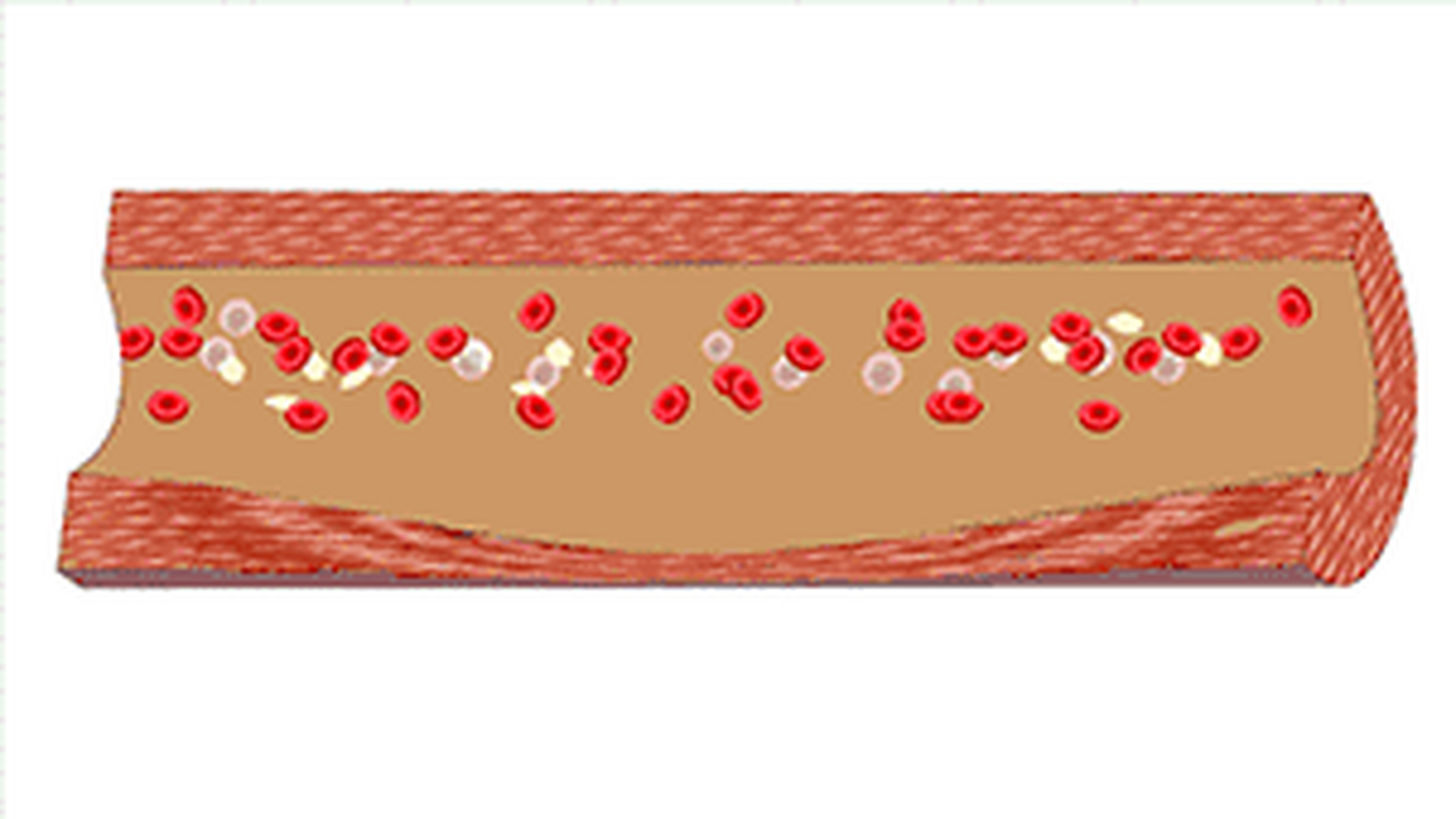 【低压高和高压高,哪个对身体危害更大?