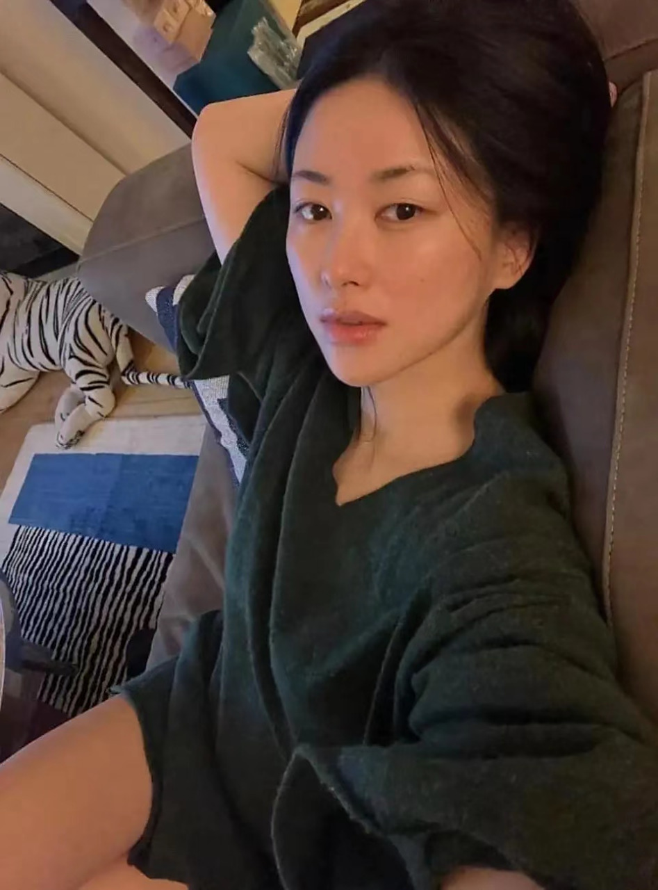 以前朱珠的嘴上有一颗很明显的痣,很有辨识度.