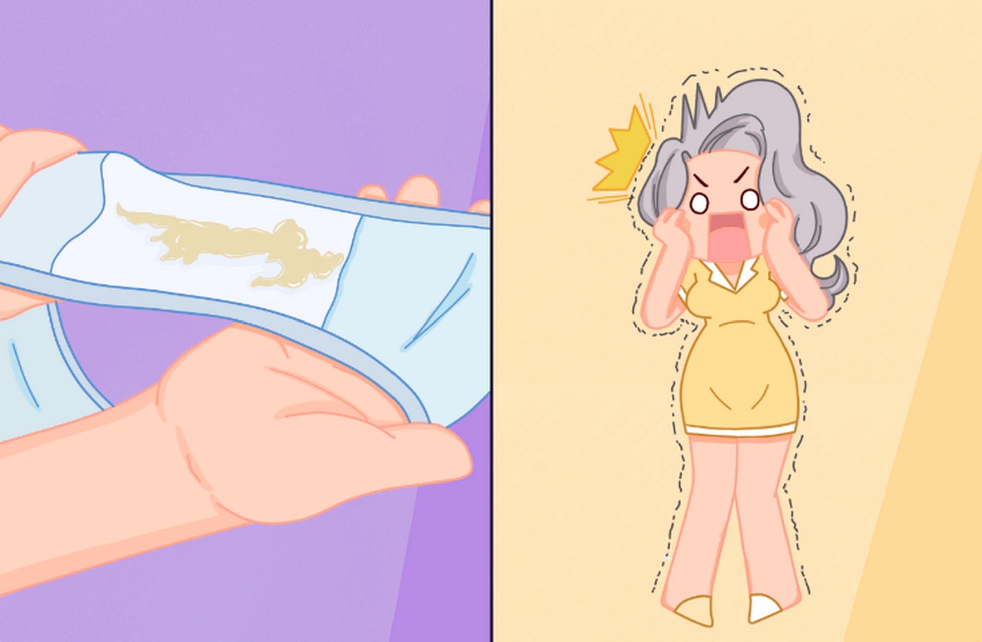 霉菌性阴道炎是孕妇常见的阴道炎症,它是由于女性