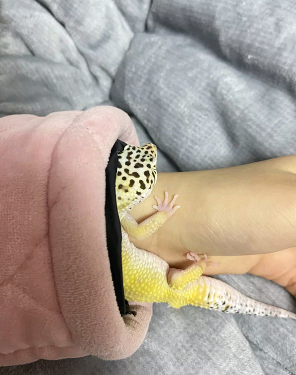 被守宫咬了一口,要不要去打疫苗?