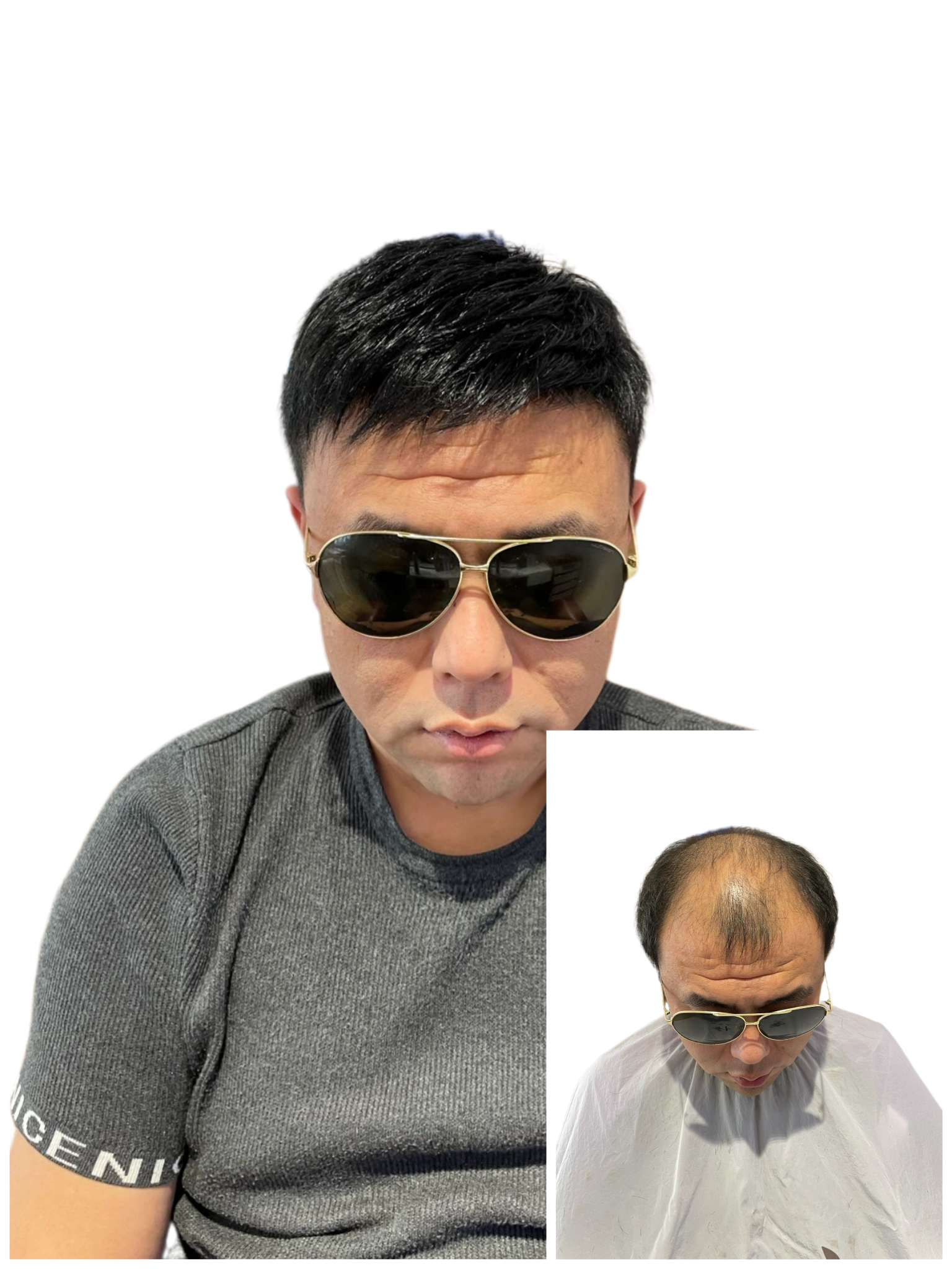 南阳隐形假发告诉您,这样选就对了