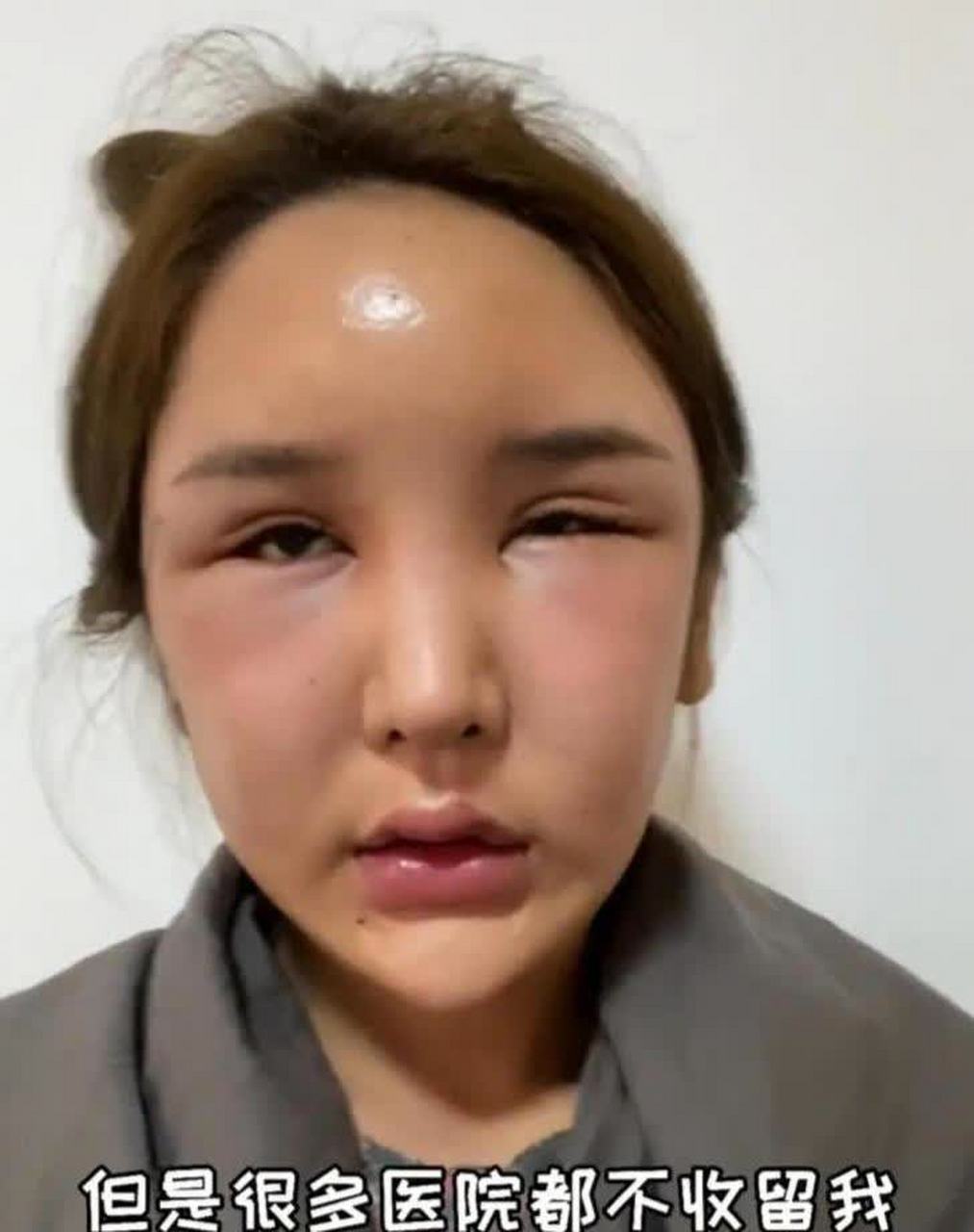 人造美女"桃花宝宝",8年整容连亲妈都快认不出,这是图啥呢?