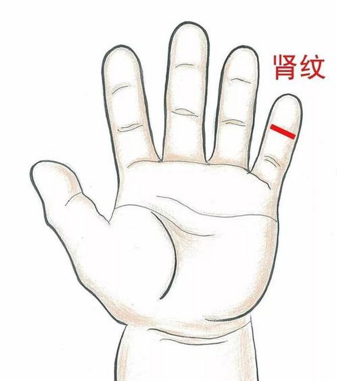 今日穴位分享 肾纹 定位:手掌面,小指远侧指尖关节横纹处 操作:揉