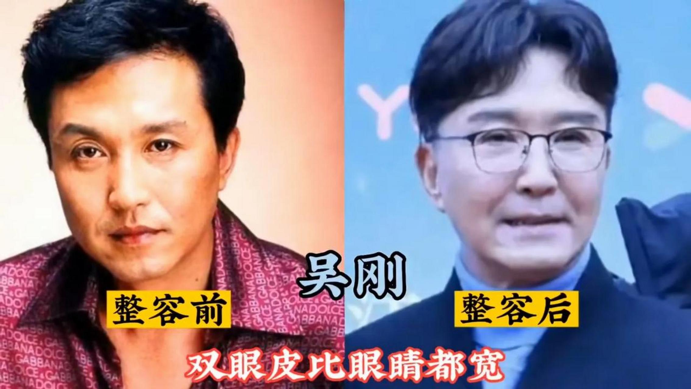 "天生优质"脸不要,非要整成"歪瓜裂枣"的10位明星,看看都有谁如今的