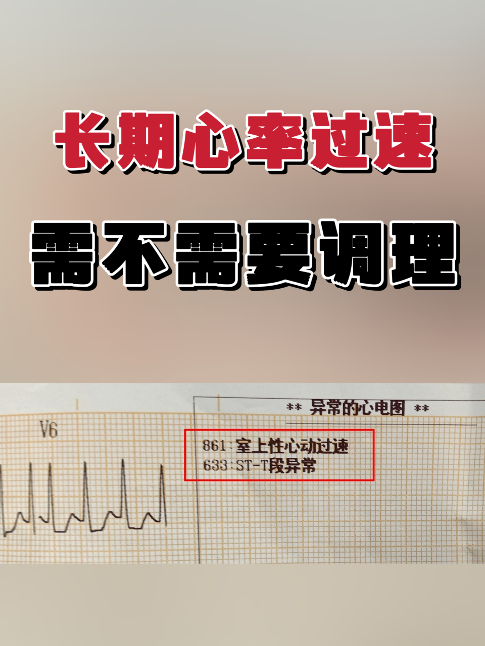 需不需要调理  粉丝提问:心率过速有三年多了,有时候心率忽然增快