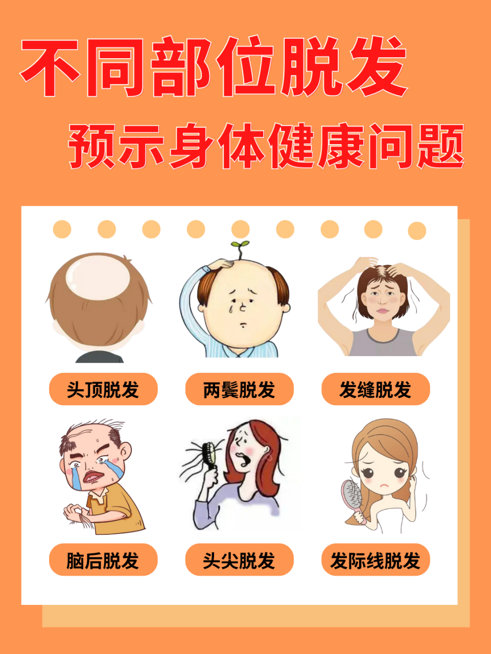 不同位置脱发原因和调理方法: 头顶脱发 原因:作息紊乱,精神压力  