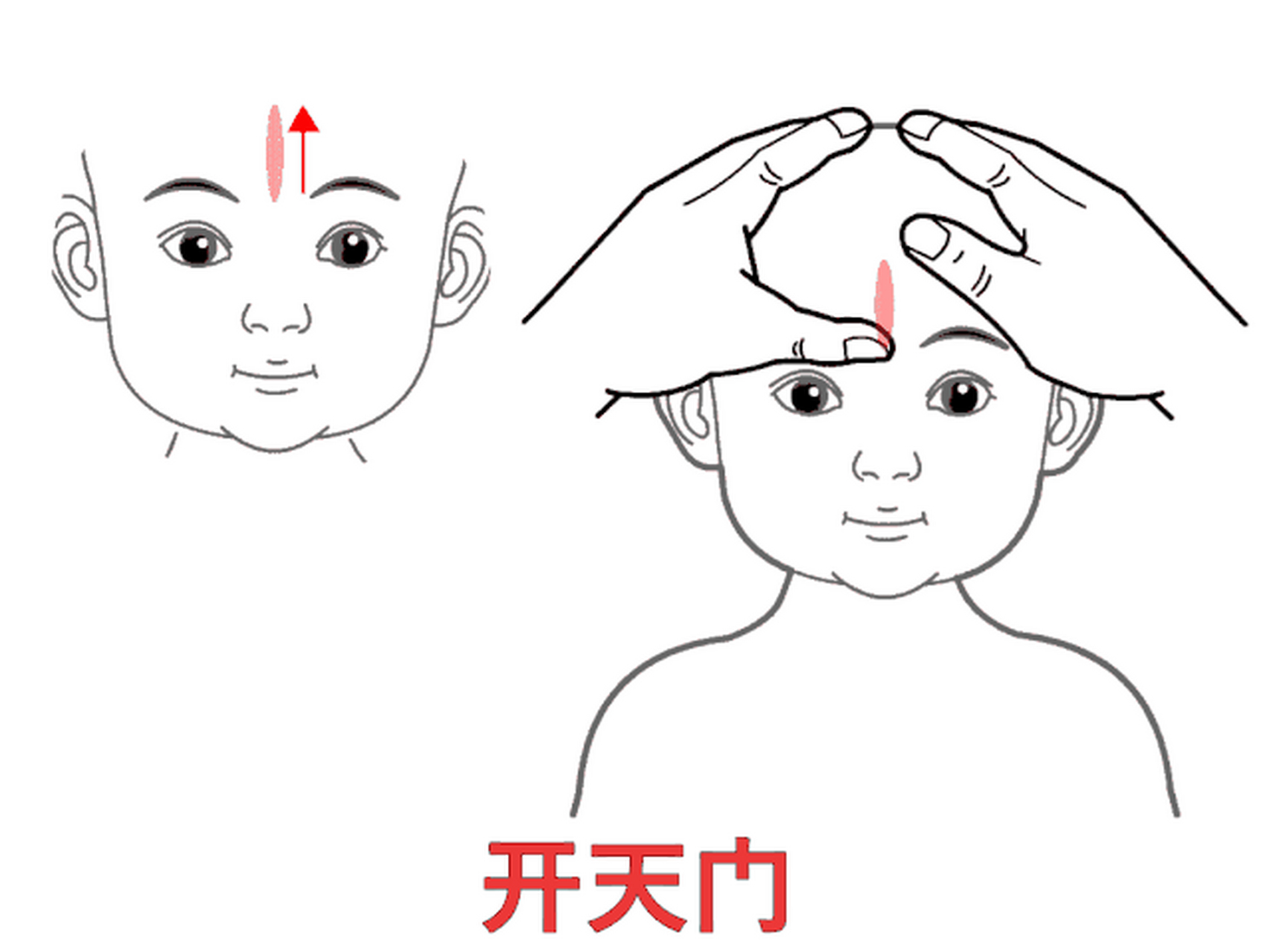 宝宝感冒初期的推拿手法 风寒感冒,风热感冒均适用.