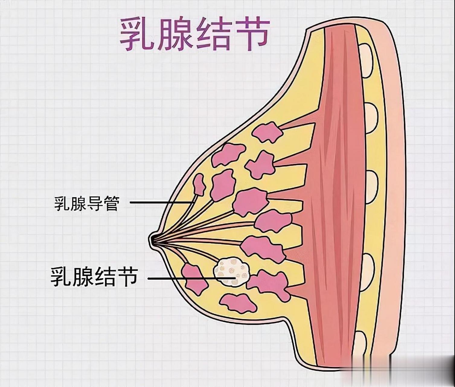 乳腺腺体组织图片