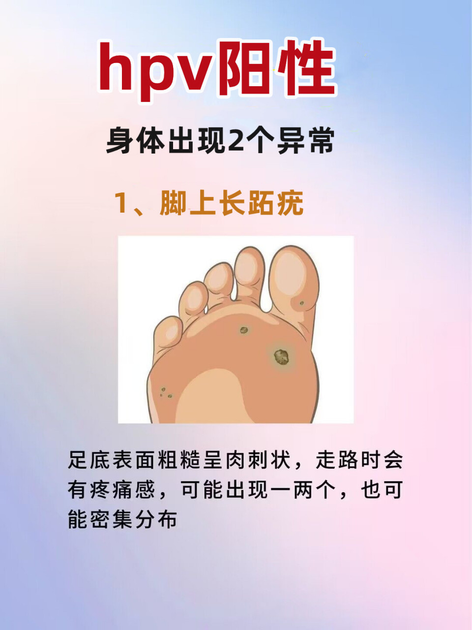 感染hpv后,手和脚会出现2个症状!