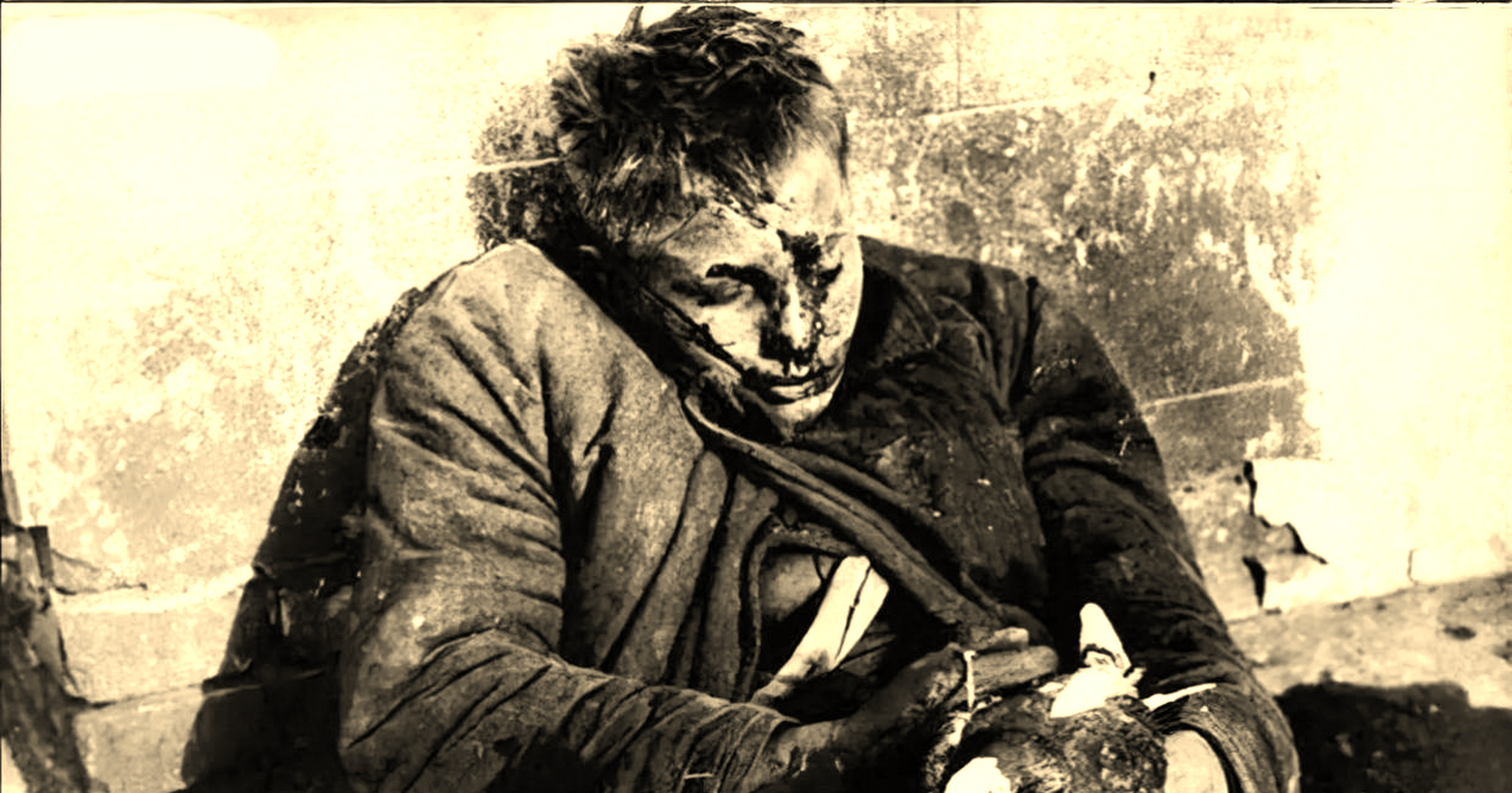 下面这张照片中的男孩子太惨了,他已经被打的头破血流,依偎在墙上;他