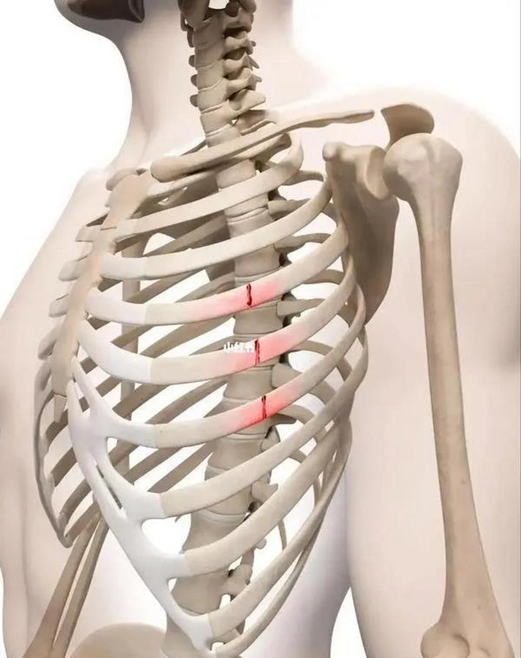 "医生,别人锁骨骨折,住院第二天就手术了,我这都一个星期了,还不能