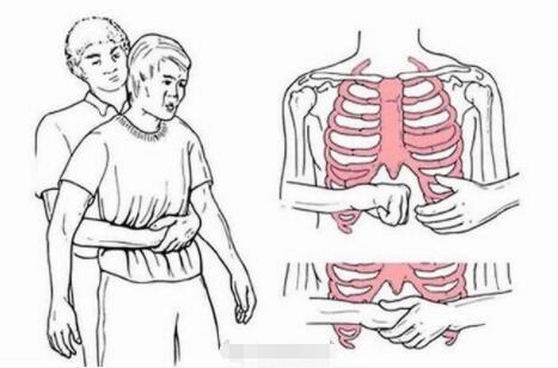 你可以这样救他,拳头的位置在这里,上腹部,肚脐之上