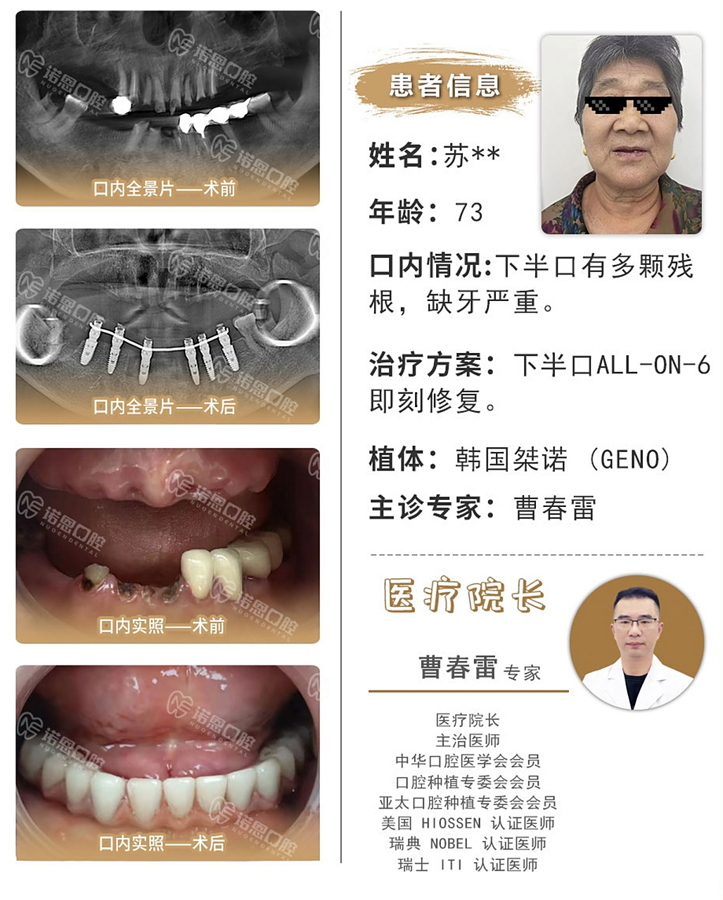 七八十岁老年人可以种植牙吗?