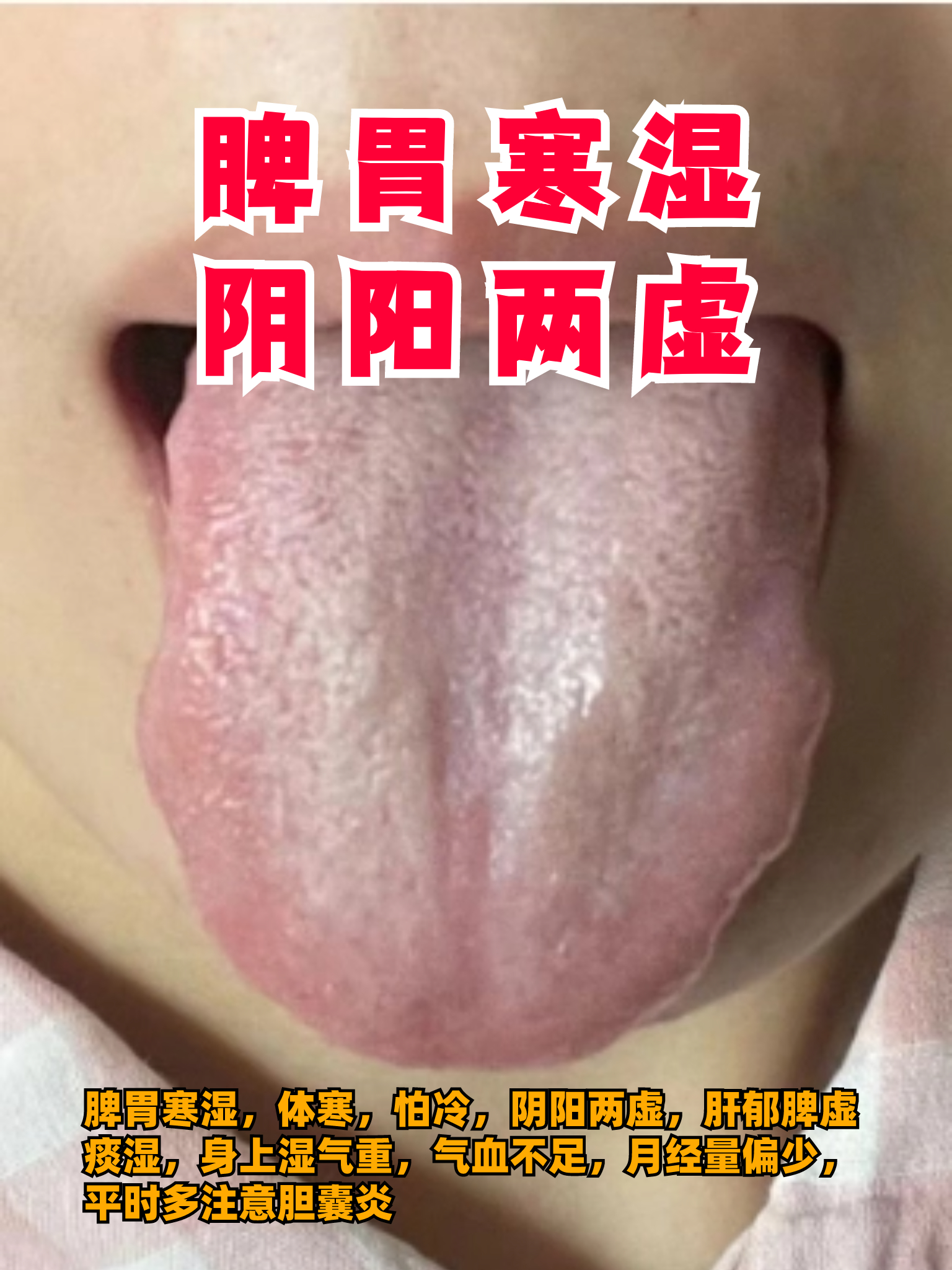 阴阳两虚的症状图片