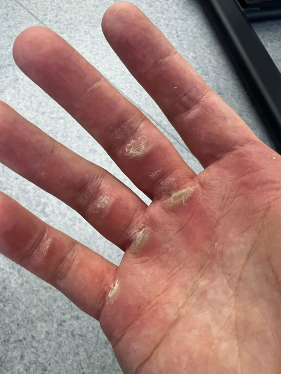 健身的人都有一双磨人的手  手上的茧是健身人的勋章! 手感不错的哈哈