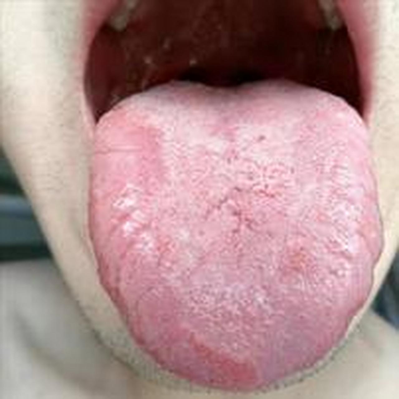 你的早泄类型是:肾阳虚吗?