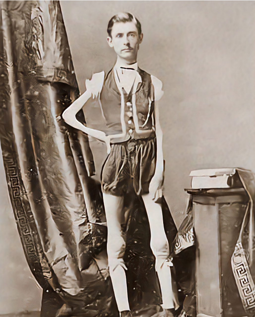 照片中骨瘦如柴的男人,名叫艾萨克·斯普拉格,是巴纳姆马戏团中的一名