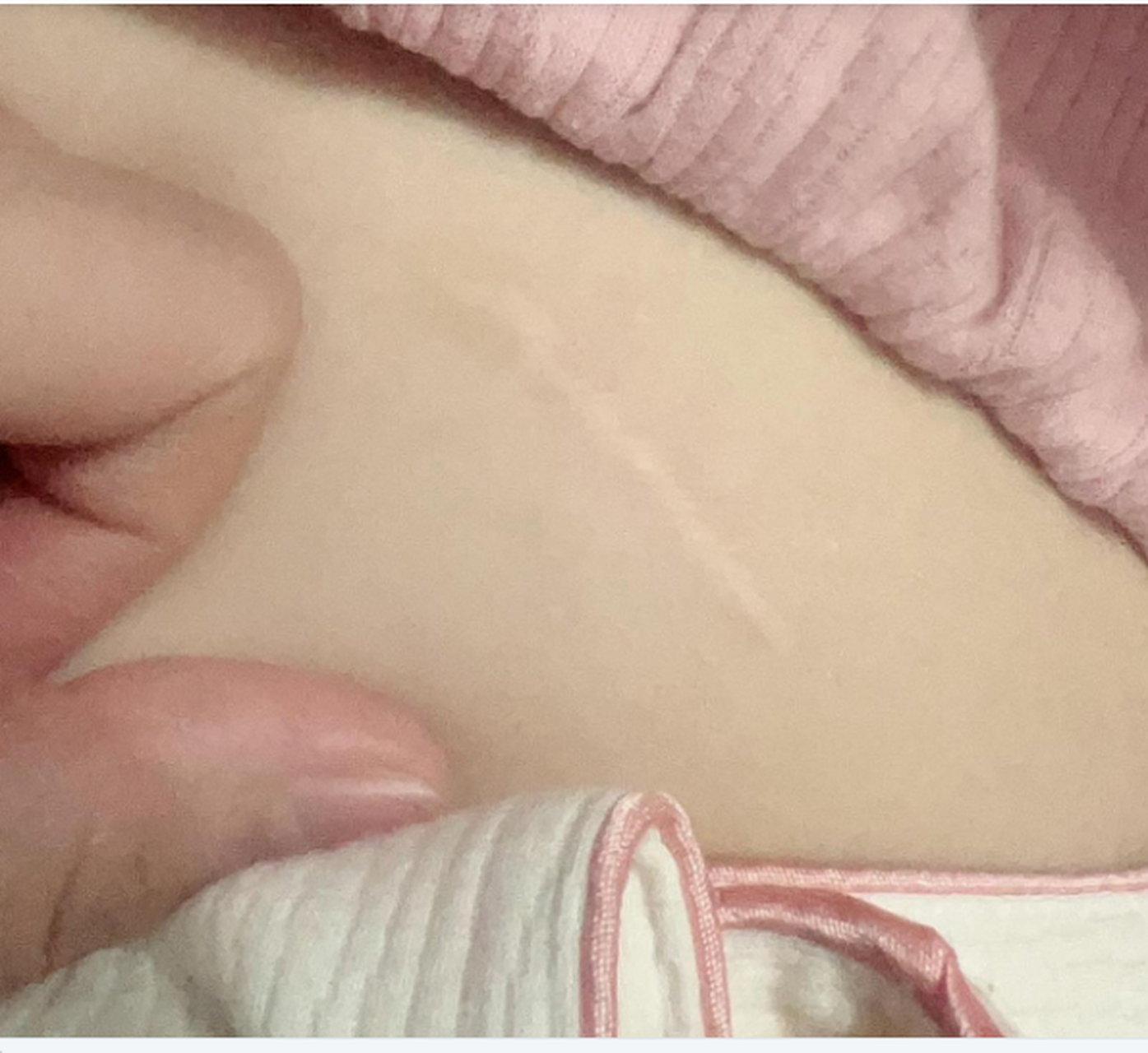 对象说她肚子上这个疤是当年吃两碗米线只给了一碗的钱,还能继续吗?