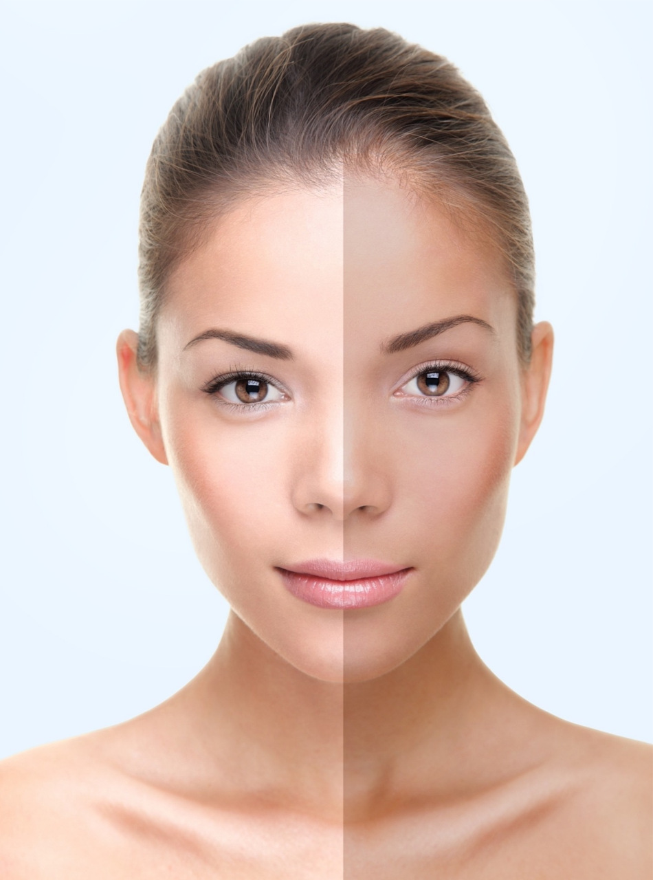 皮肤暗沉发黄是什么原因?  皮肤暗沉和发黄可能由多种原因引起,包括以