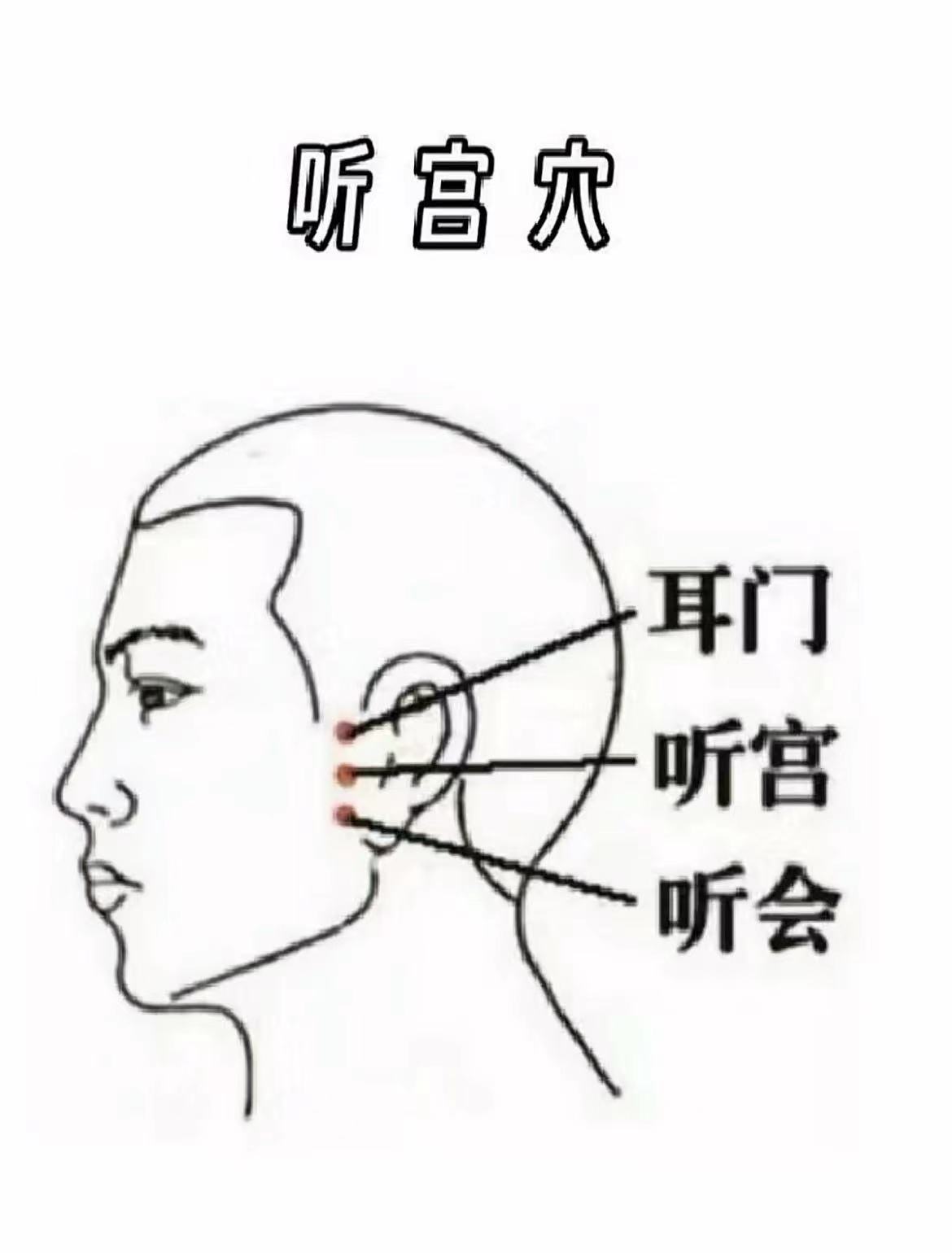 在家就可以缓解耳鸣  第一个找到角孙穴