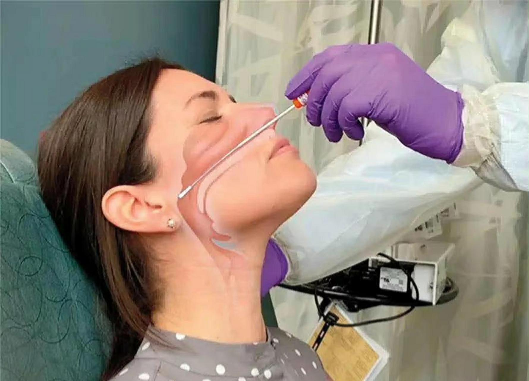 网友:核酸鼻拭子是这样的,有经历过的老铁不?