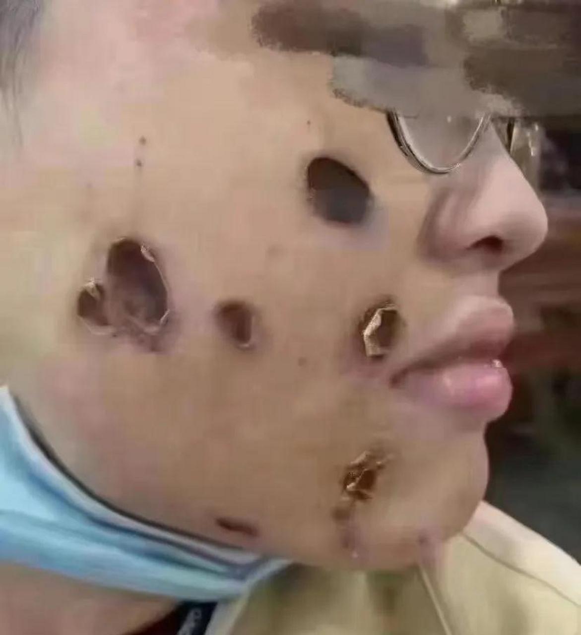 千万不要在网上,直播间乱买药水往脸上涂,什么点痣,祛斑呀!