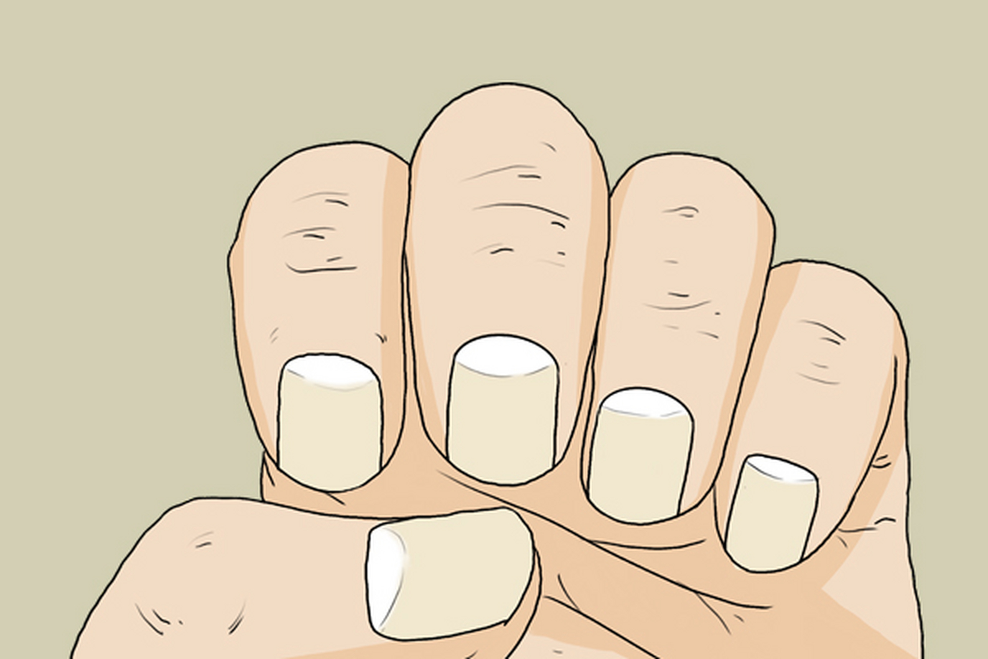 这表现身体气血不足,多是女性有这种指甲,女性由于特殊的生理结构