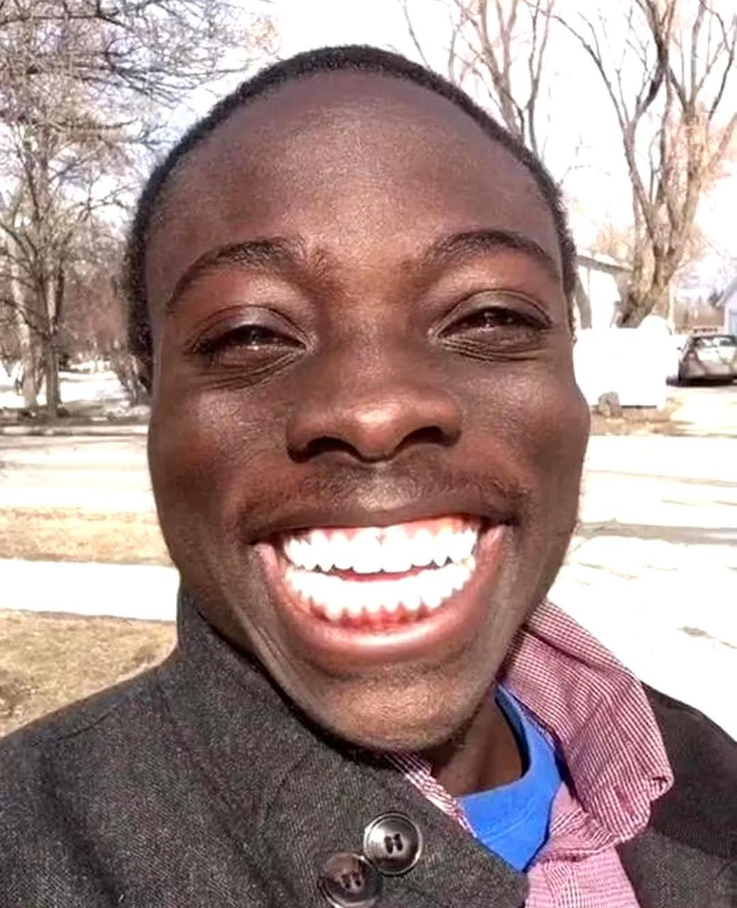 黑人的牙齿也可以很白哦.