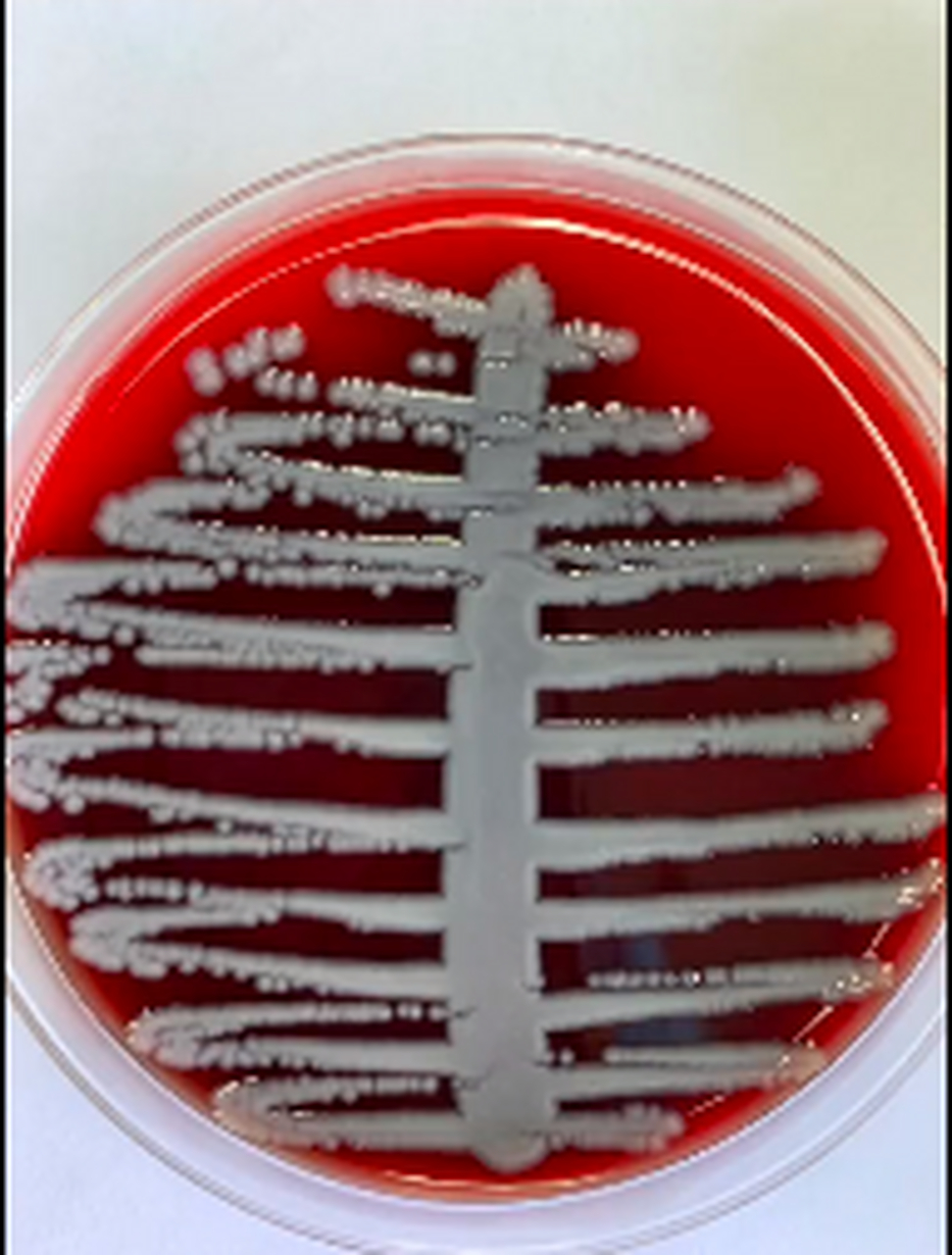 最近在尿路感染的样品中,发现了一种细菌,提取并培养了一下 来个大佬