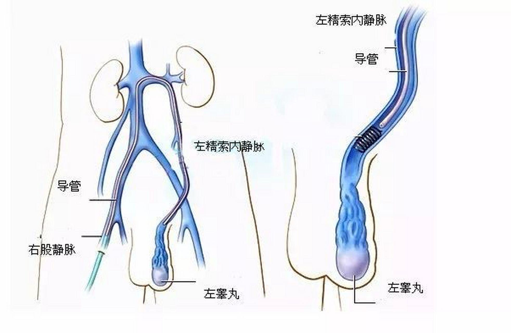 睾丸血管结构图片