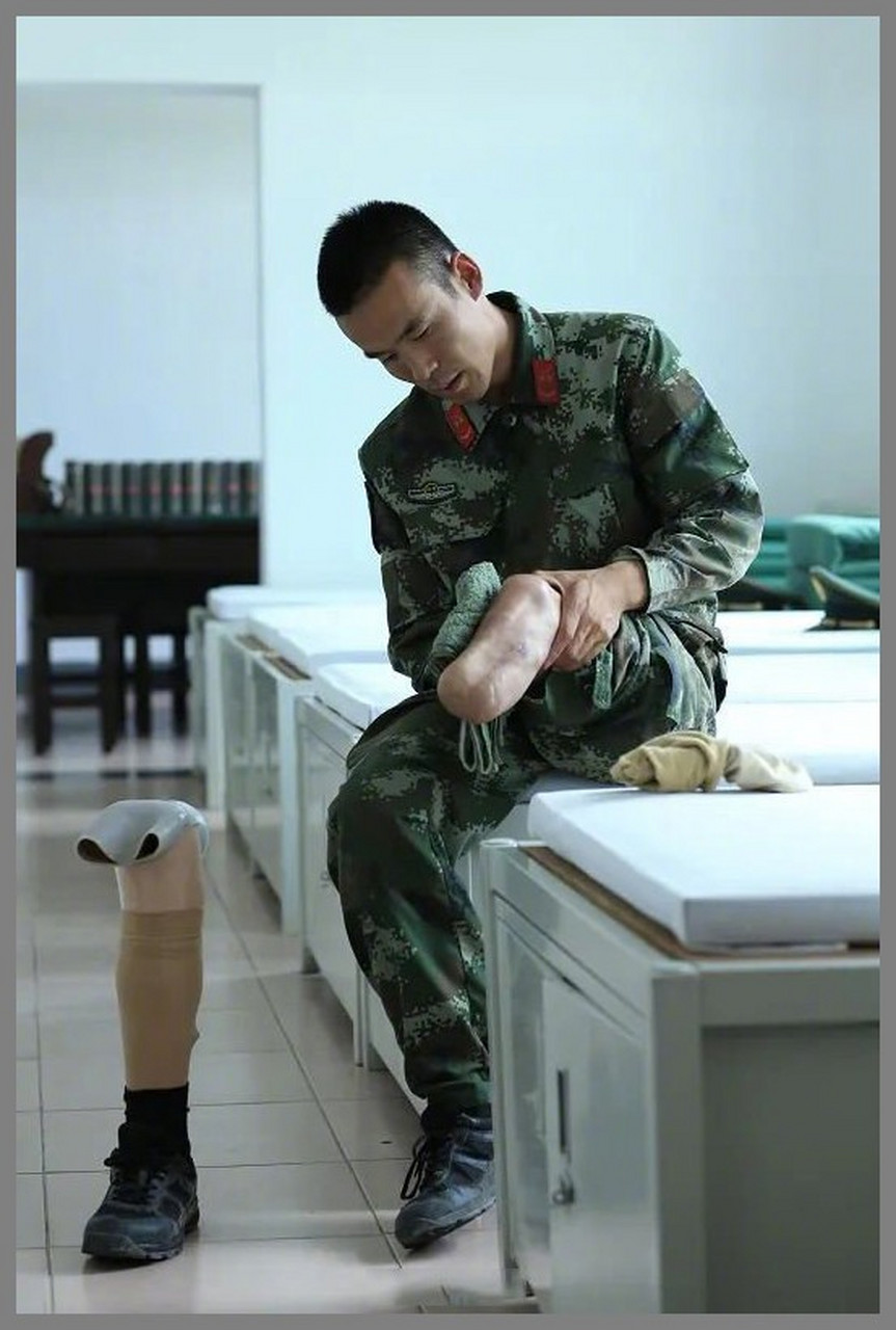 武警战士郑明岗,突患动脉血栓脉管炎,左小腿截肢6次,经历4次病危抢救.