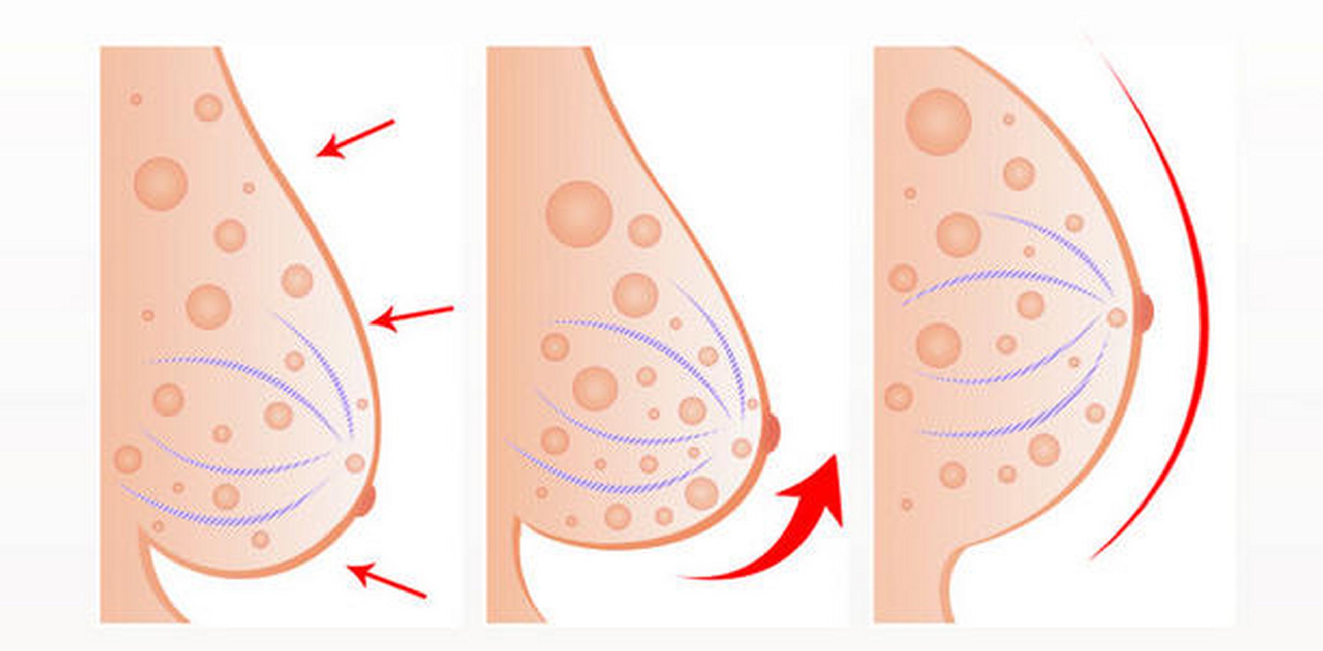 "乳房按摩"的3个谣言你必须知道!