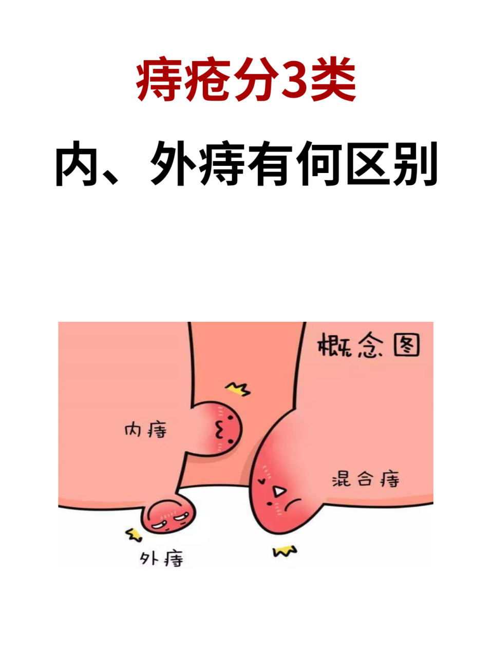 内痔和外痔有什么区别?