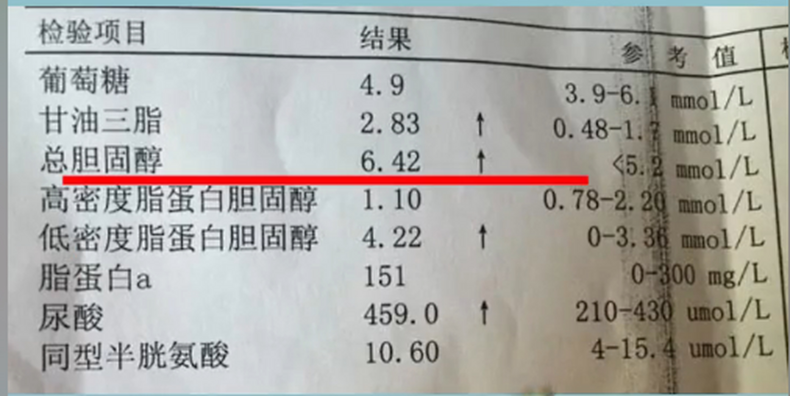 希望大家拿到血脂报告单时,这些指标永远不会高  1,低密度脂蛋白升高