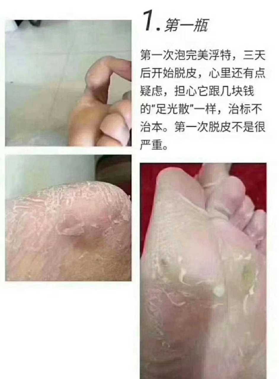 美浮特皮肤抗菌液效果图片