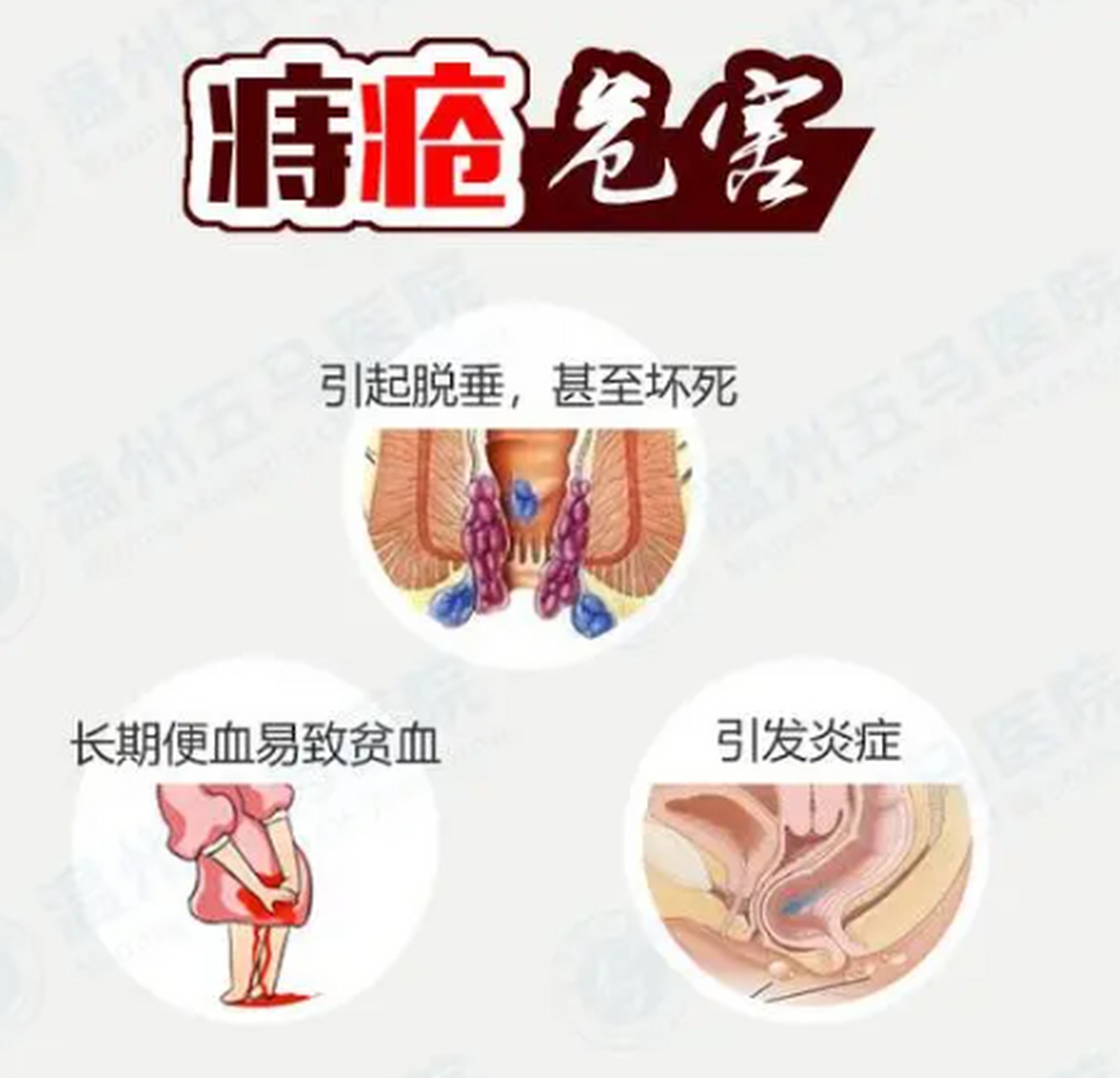 外痔疮会出血吗图片