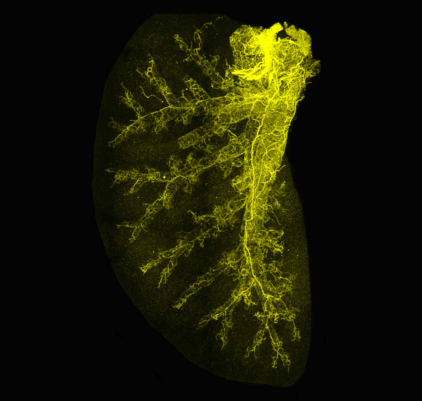 科研速递# #荧光显微镜# 高分辨率荧光成像,探究生命之谜,光片显微镜