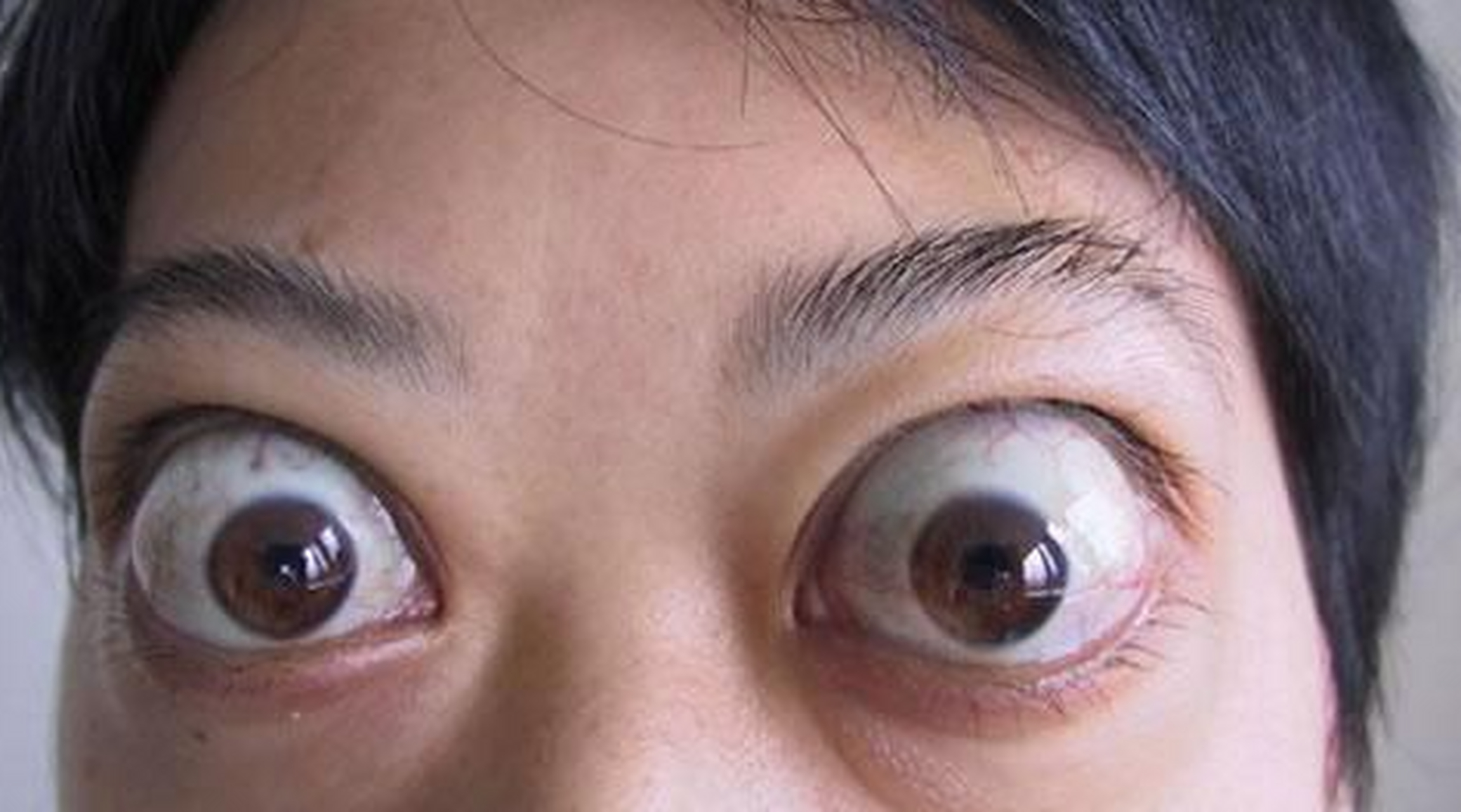 若这些表现你有,别再怀疑了,是甲亢给你"找麻烦"了!