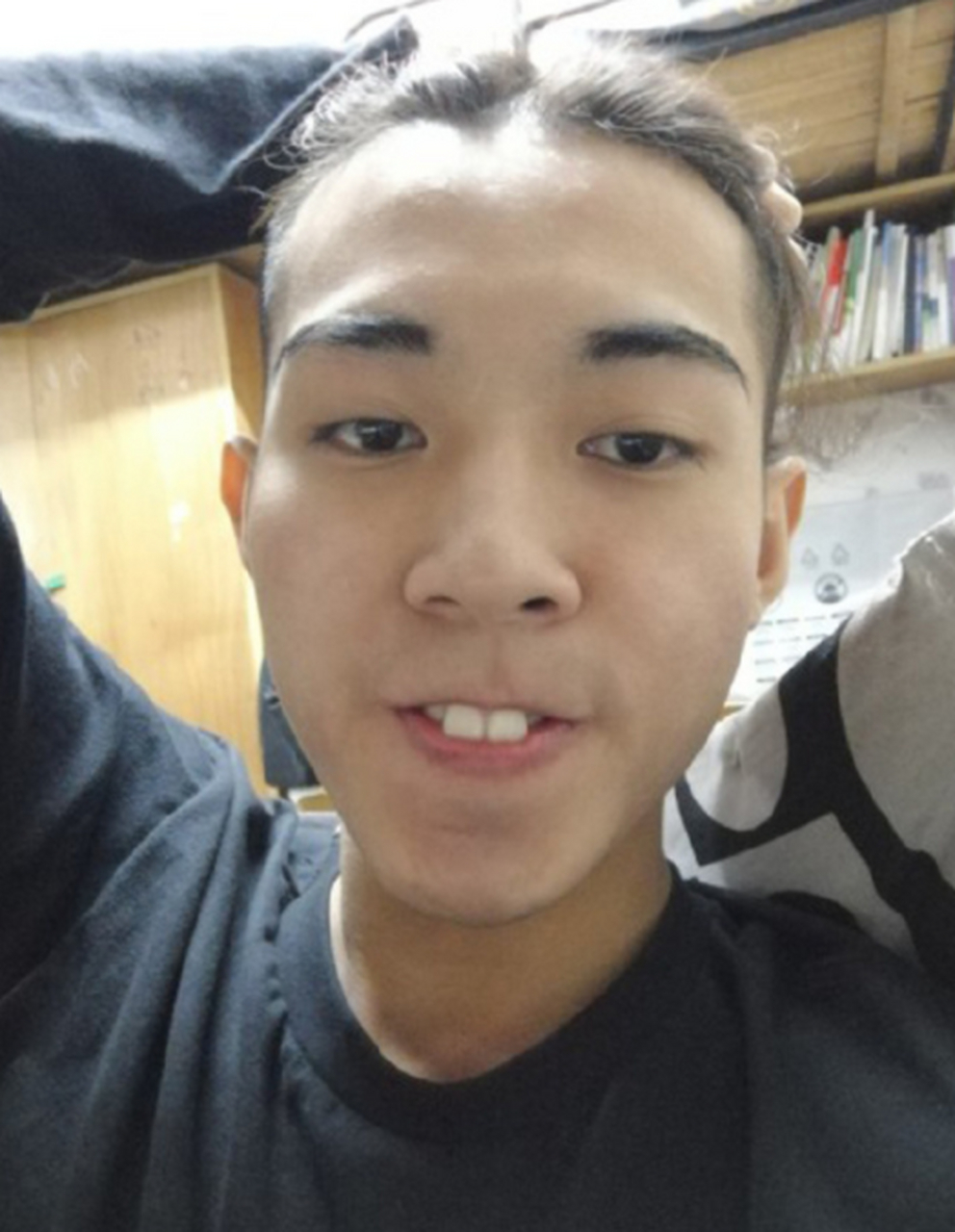 有没有人喜欢长兔牙的男孩子