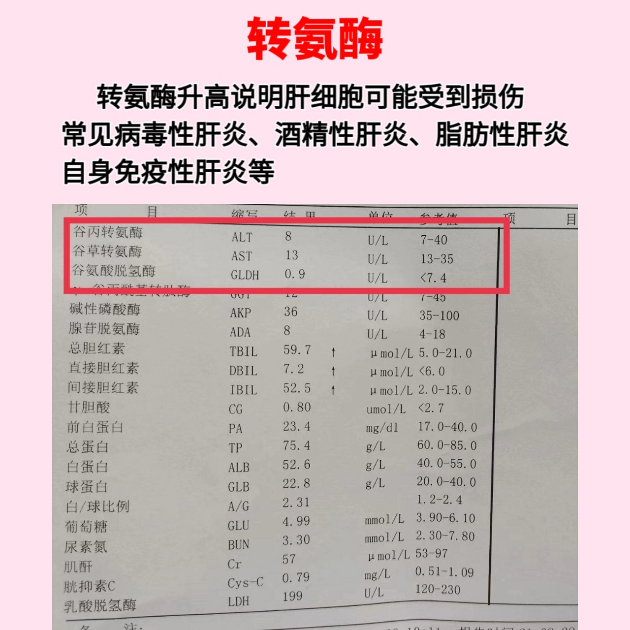 在肝功能单子里,最常见的两种反映肝细胞功能的酶,就是谷丙和谷草