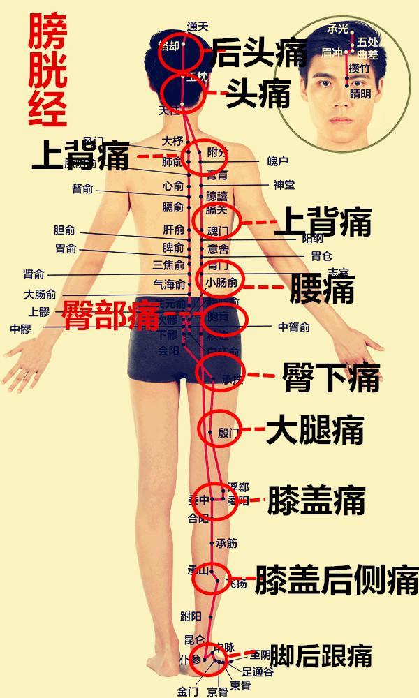 就是这里痛那里痛,这些疼痛,很多时候与身体经络不通有直接的关系