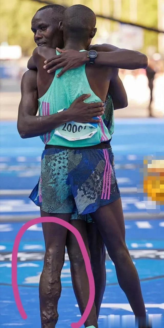 看照片这小腿有点吓人了!