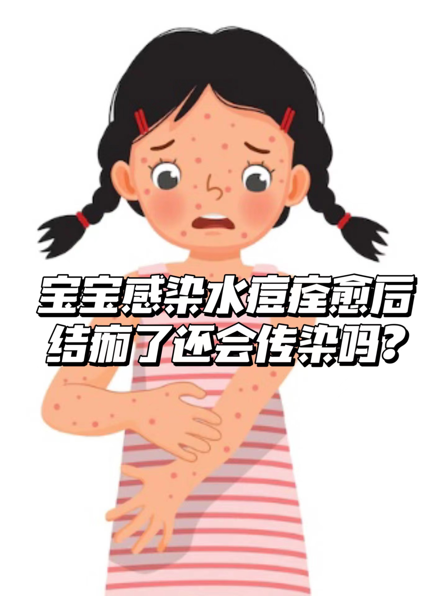 水痘图片小儿卡通图片