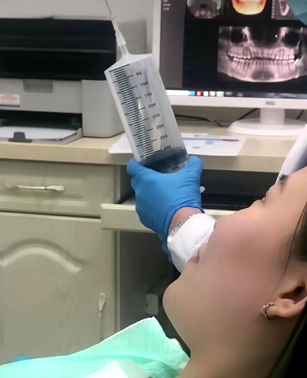 患者:你用这么大的针,是不是要给我打麻药啊?